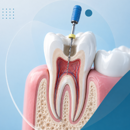 Teeth Whitening